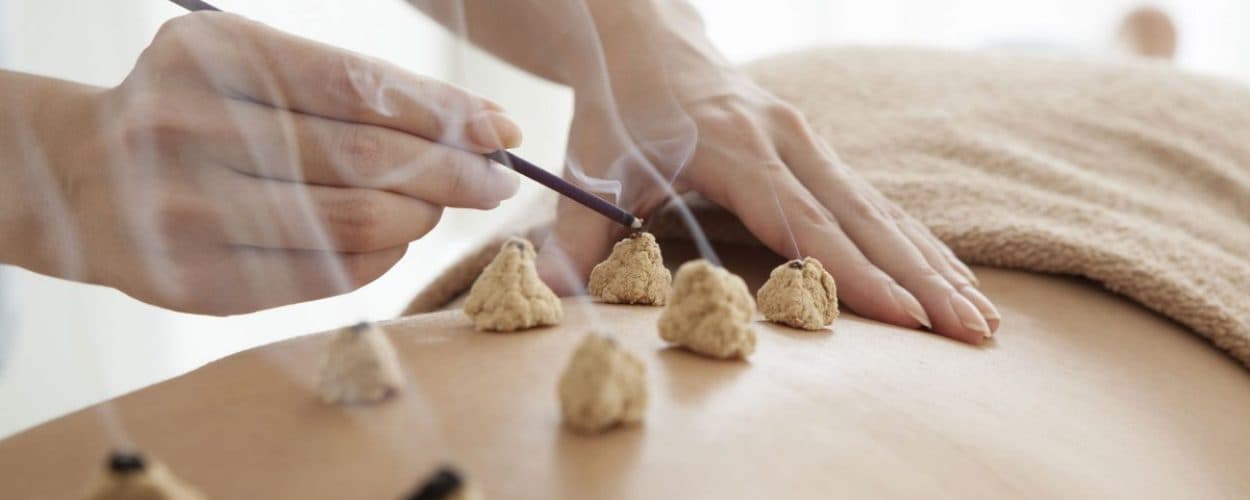 Moxibustion